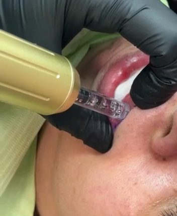 5ba3b555-660f-4495-8c78-f10eaecfb58e