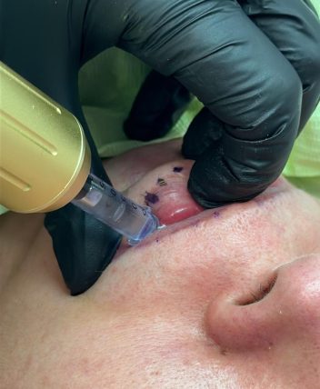 79e19d95-1877-4495-8eca-f42a7887cc7c