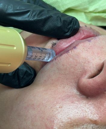 96645297-7cad-4d07-9231-8896afe696c7