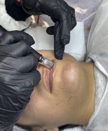 a0bcb44a-7b5e-4156-a09c-dd1f56b95203